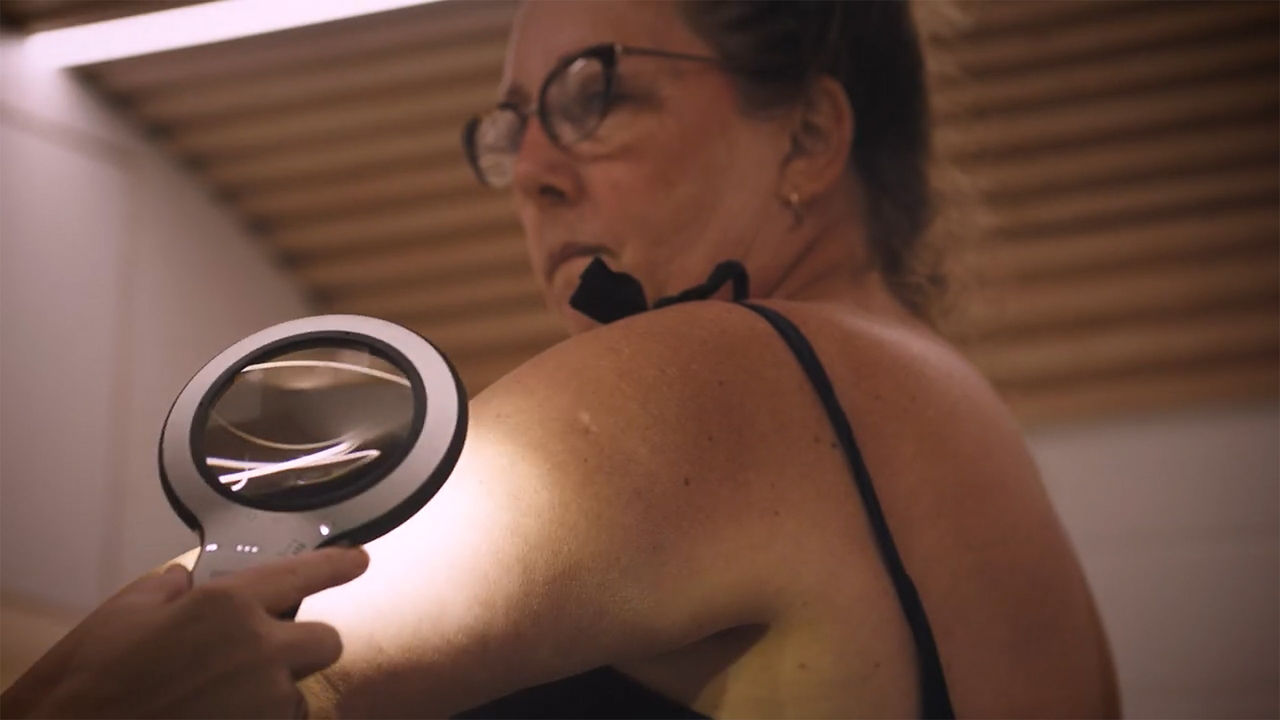 Person having a skin check with a magnifying light.